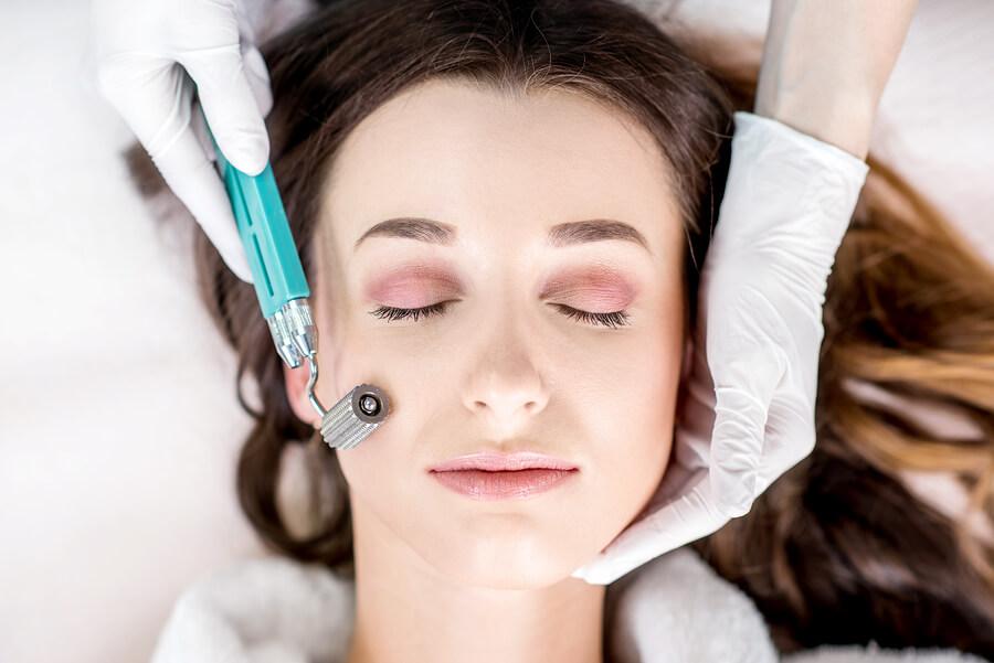 Microneedling 101